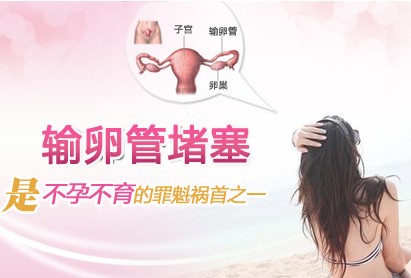 输卵管堵塞美女.jpg